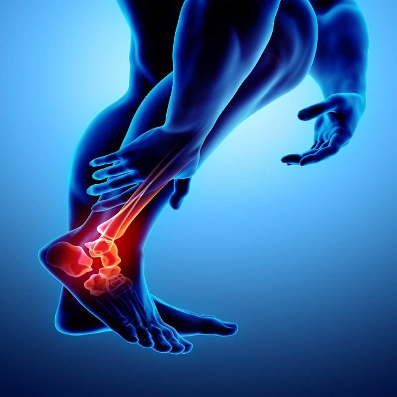 Ankle painful - skeleton x-ray. best chiropractor in boca