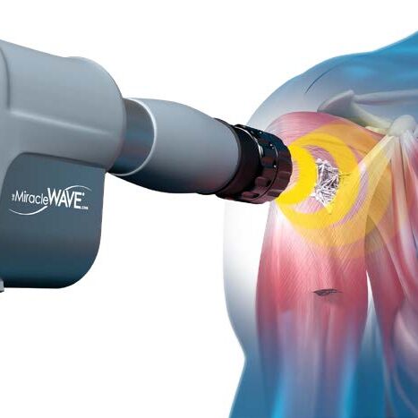shock waves penetrate deep